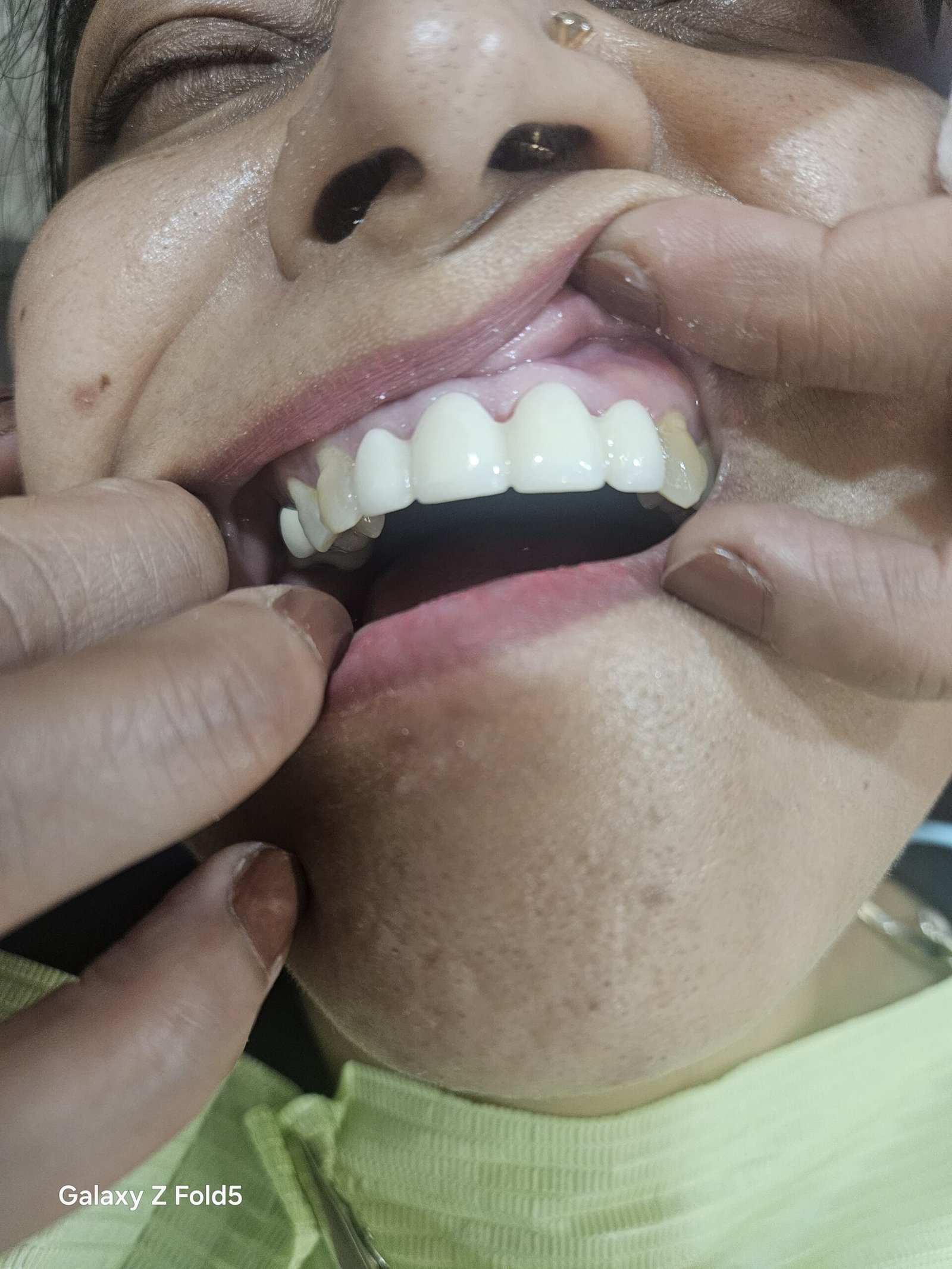 WhatsApp Image 2025-07-04 at 2.26.19 PM (2)